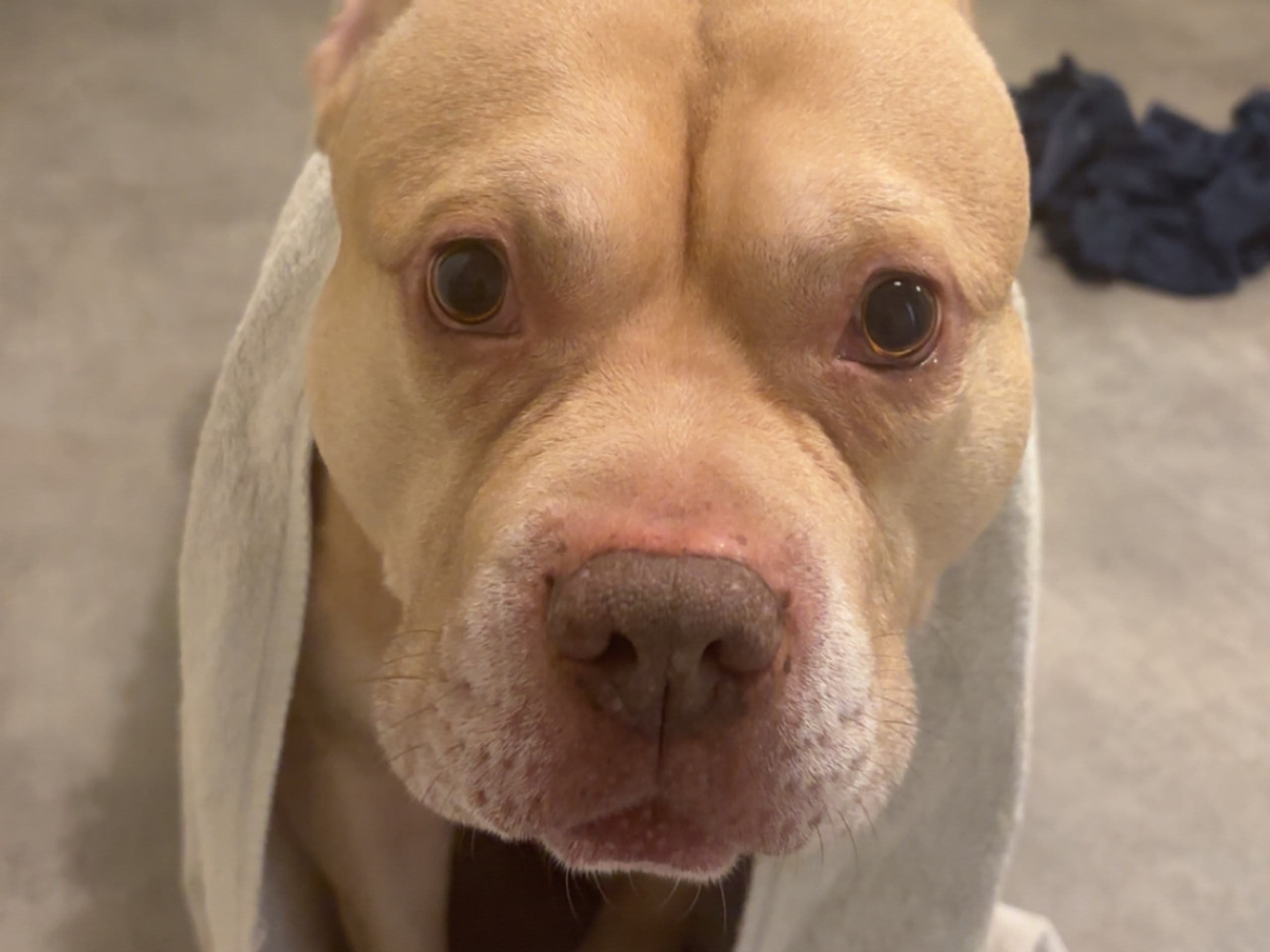 Akilles